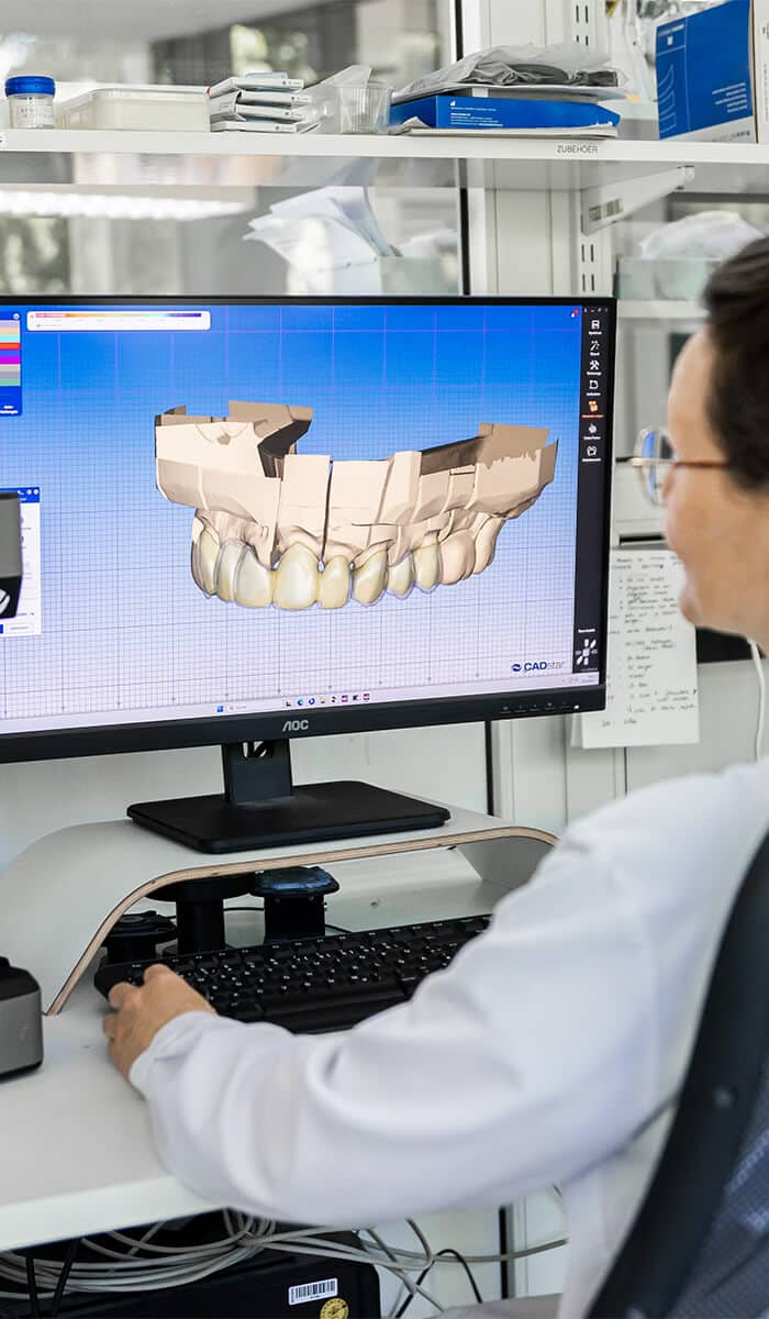 3D-Modell eines Gebisses auf einem Computermonitor.