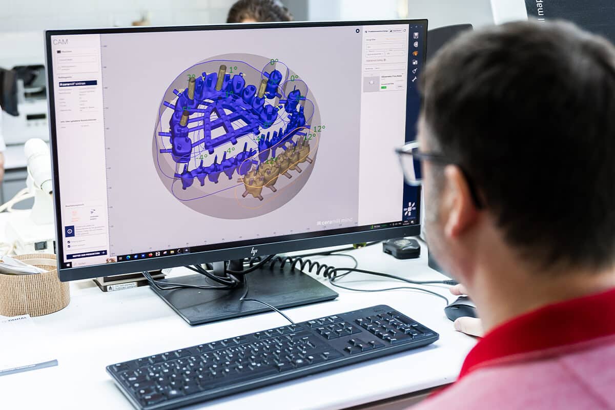Person sitzt vor einem Bildschirm mit 3D-Modell eines Kiefers in blauer und beiger Darstellung.