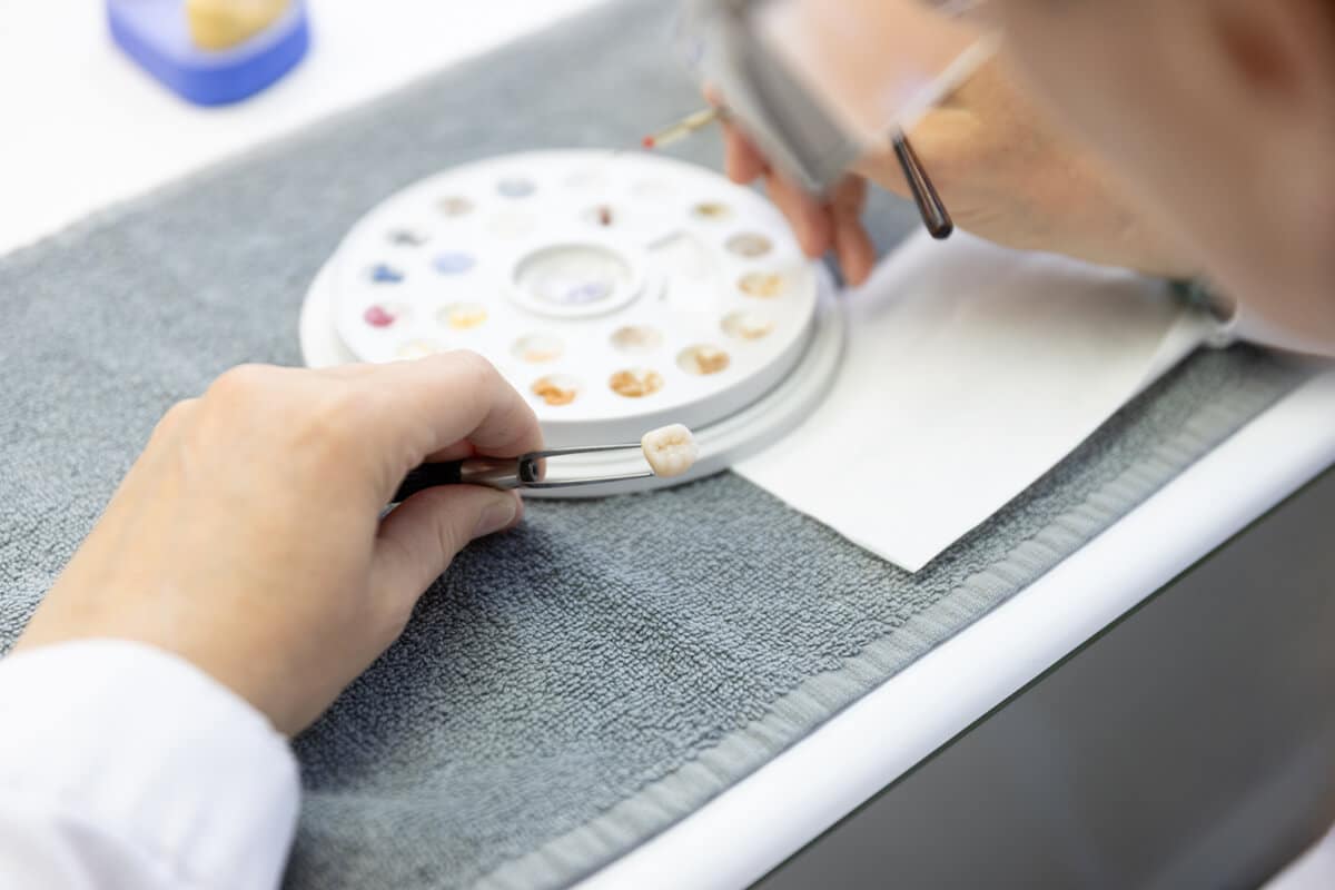 Hände halten einen Zahn und einen Farbring mit verschiedenen Zahnfarben auf einem grauen Tuch.