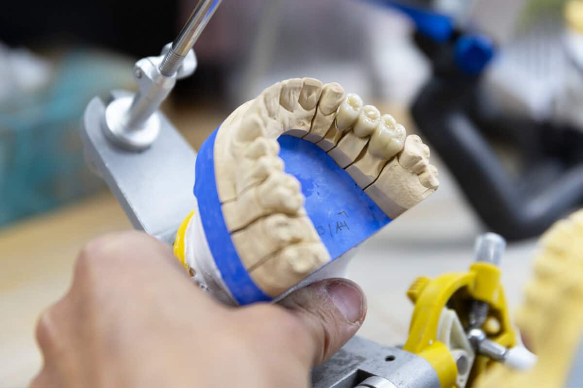 Hand hält Zahnmodell, das in einem Halter fixiert ist.