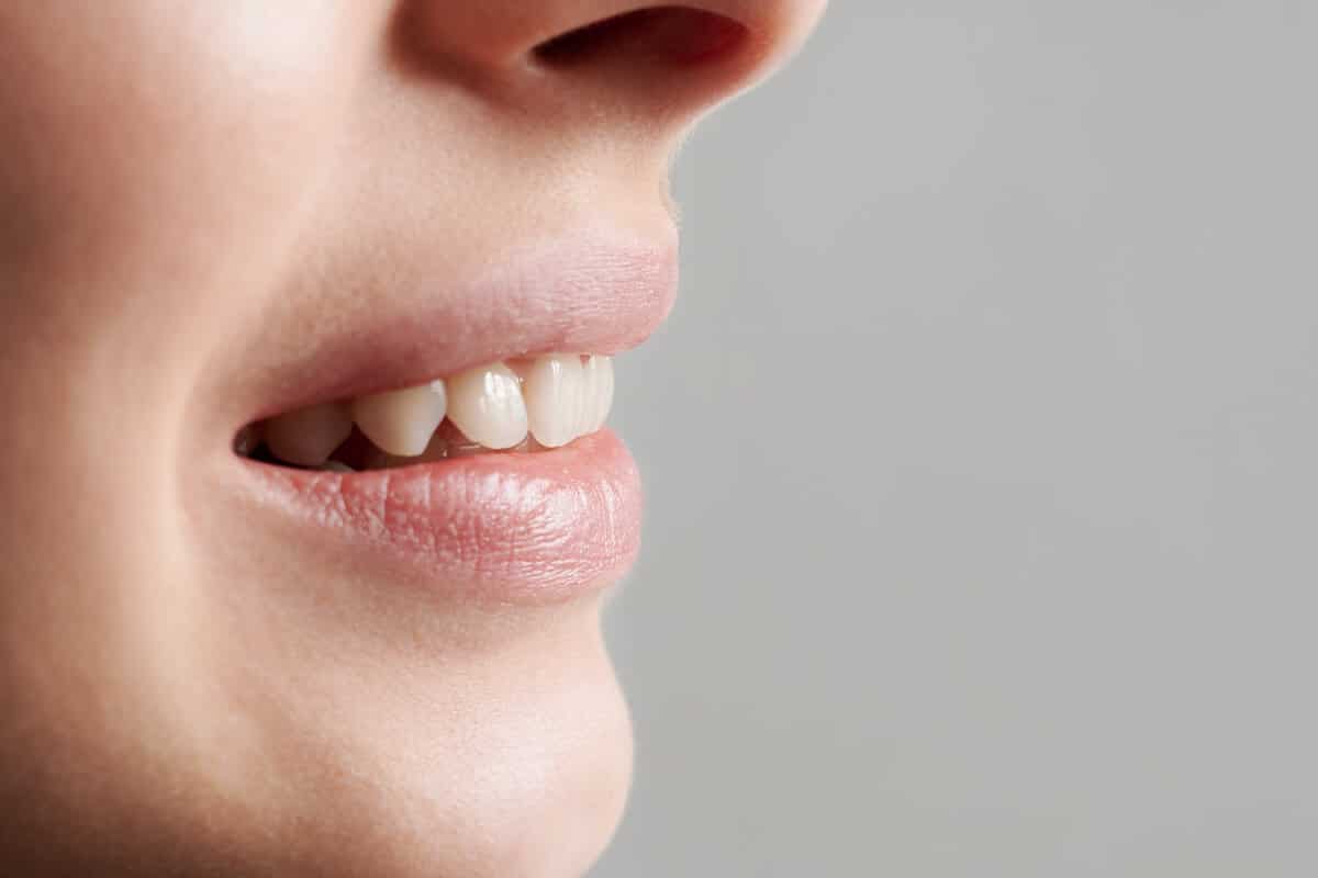 Nahaufnahme eines geöffneten Mundes mit sichtbaren Zähnen und Zahnfleisch.