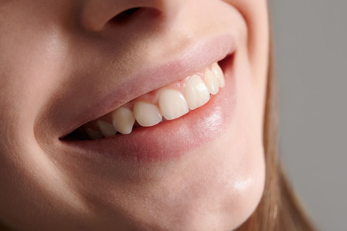Nahaufnahme eines lächelnden Mundes mit sichtbaren oberen Schneide- und Eckzähnen.
