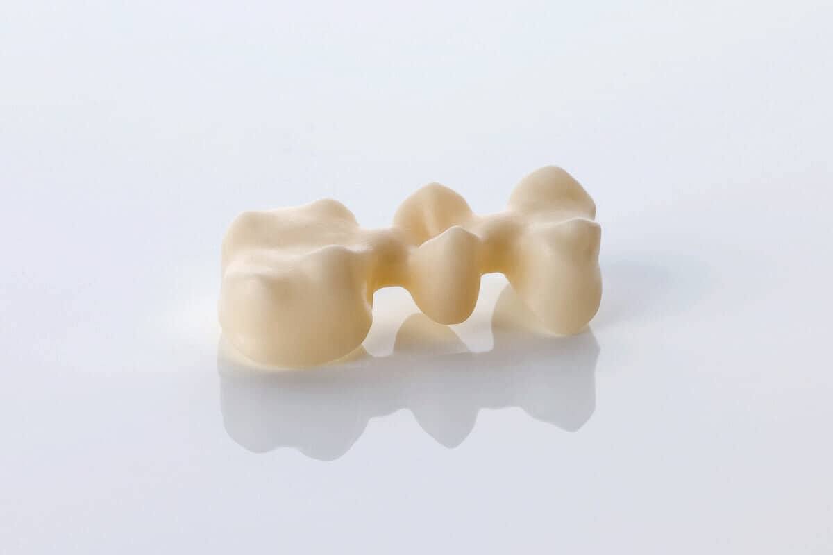 Nahaufnahme eines zahnförmigen, hellen zahnmedizinischen Brückenglieds.